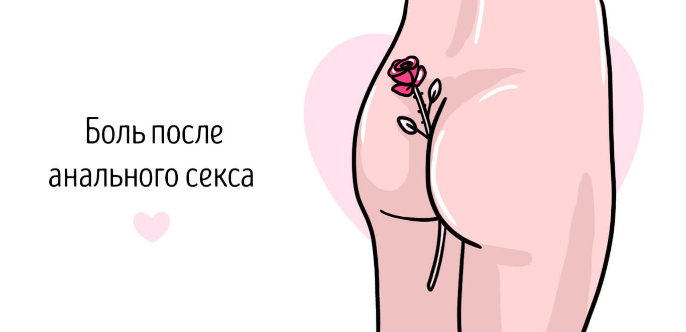 Боль после анального секса