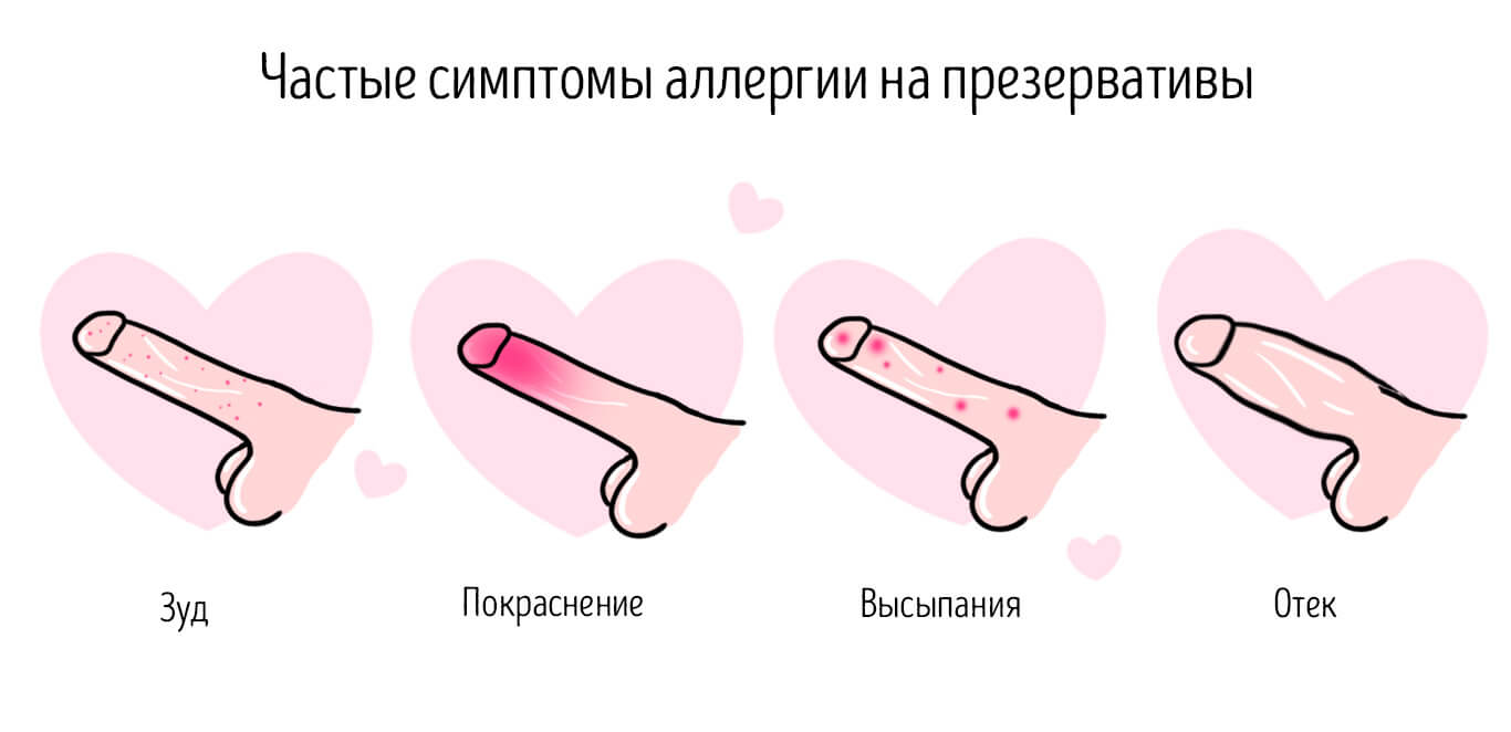 как проявляется аллергия на презервативы