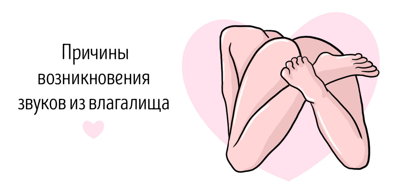 Причины квифинга