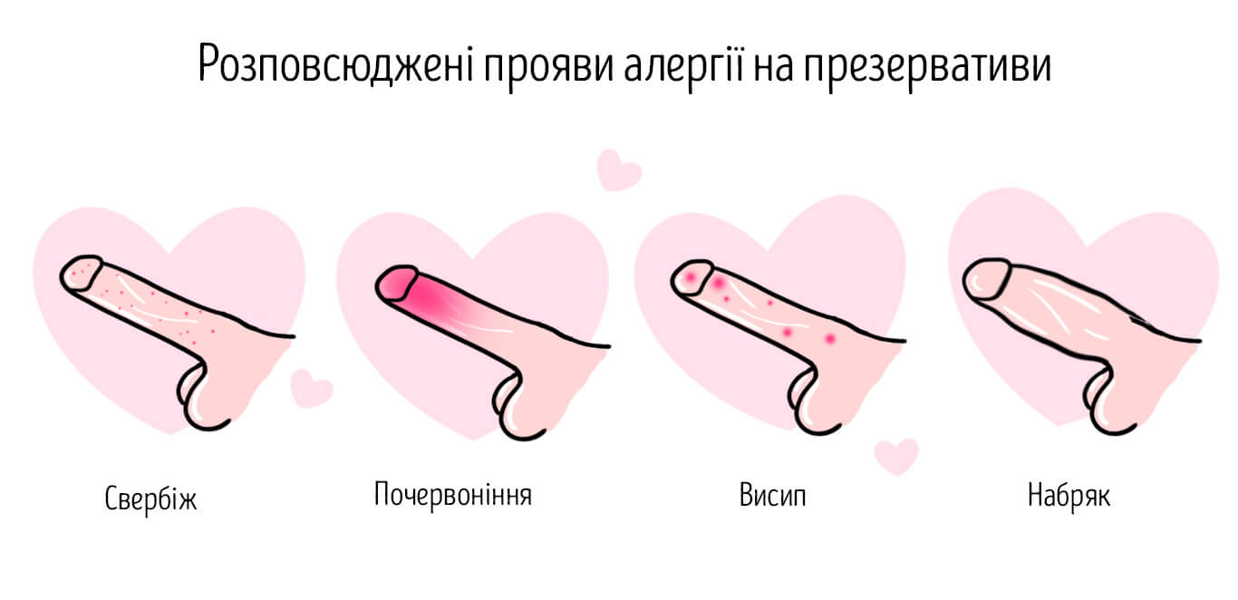 як проявляється алергія на презервативи